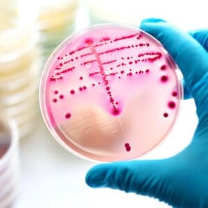 Spezielle Hygiene bei multiresistenten Erregern