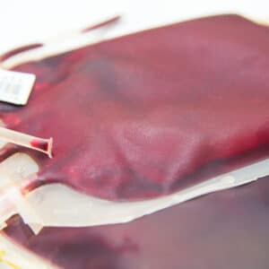 Transfusionsmanagement (Ärztliche Mitarbeiter*innen)